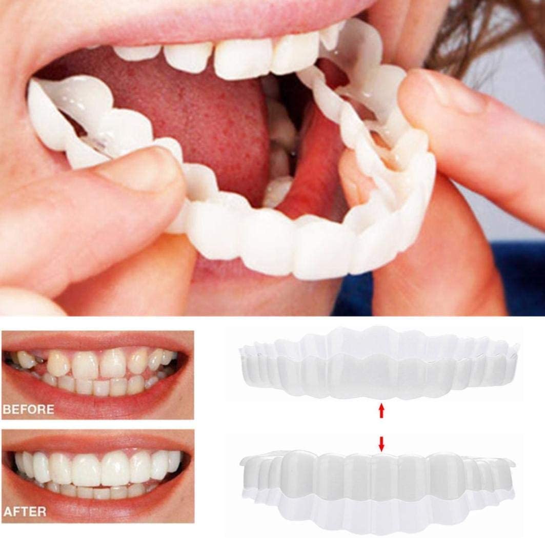 Zahnveneers Clip-on für sofortiges Lächeln & sicheren Halt – Bild 9