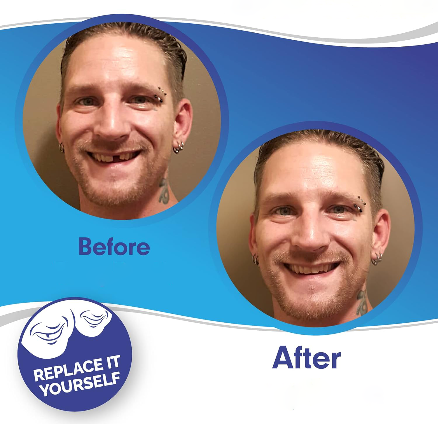Zahnveneers Clip-on für sofortiges Lächeln & sicheren Halt – Bild 2