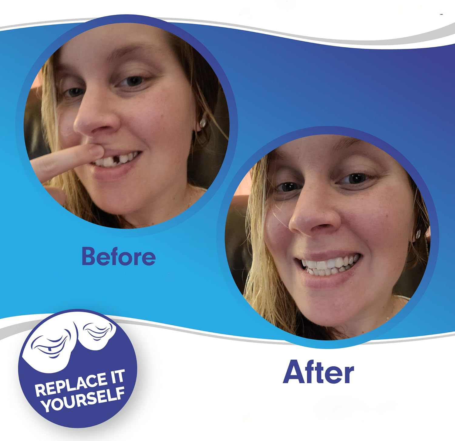Zahnveneers Clip-on für sofortiges Lächeln & sicheren Halt – Bild 3