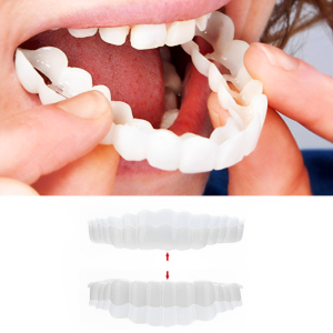 Zahnveneers Clip-on für sofortiges Lächeln & sicheren Halt