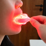 Rotlichttherapiegerät 625nm Zahnfleisch & Zähne universell